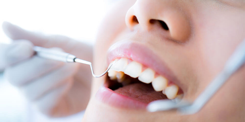 how-to-get-rid-of-bad-smell-in-between-teeth-pediatric-dental-care-of