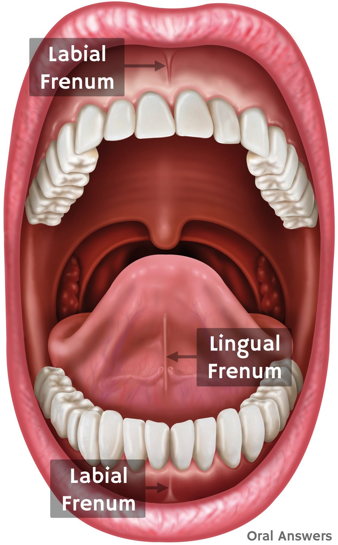 Frenum Or Diastema – Pediatric Dental Care Of Greater Orlando