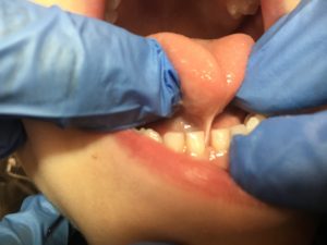 pediatric dentist oviedo